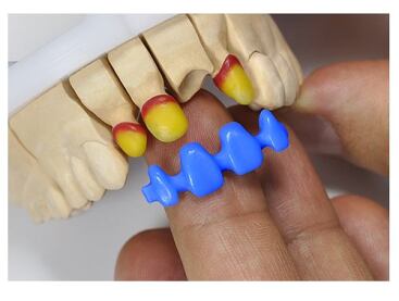 Wachs Zwischenglieder