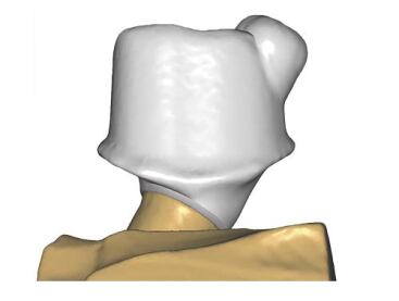 CAD/CAM Scanwachs