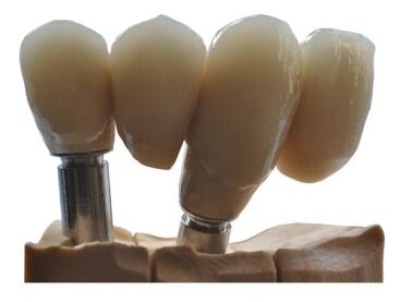 Alliage CoCr NEM 280