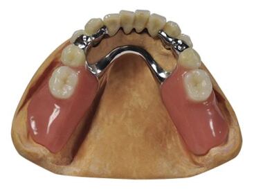 Alliage CoCr NEM 360