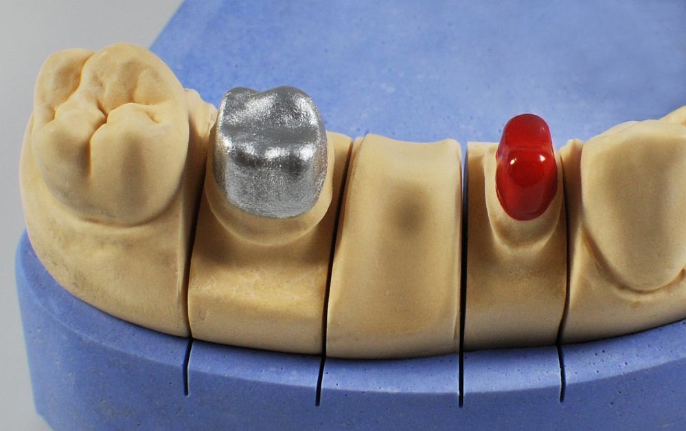 Air Hardening Varnish / Die Spacer Set CHARMING Dental Products for