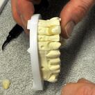 Gel Fixation Forte Céramique Zircone 2 ml