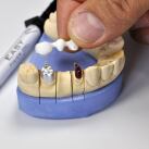 Gel Fixation Forte Céramique Zircone 2 ml