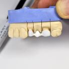 Gel Fixation Forte Céramique Zircone 2 ml
