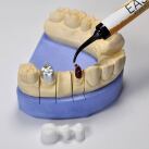 Gel de fixation Standard pour Céramique et Zircone 2 ml