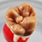 Dental Crown Waxes for Labs