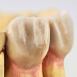 Dental Crown Waxes for Labs