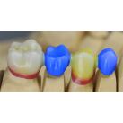 Pontics 44-47 B (small) 30 pcs